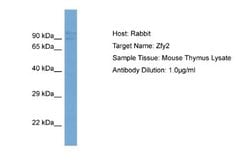 Zfy2 Rabbit anti-Mouse, Polyclonal, Novus Biologicals 0.1 mL | Buy Online | Novus Biologicals | Fisher Scientific